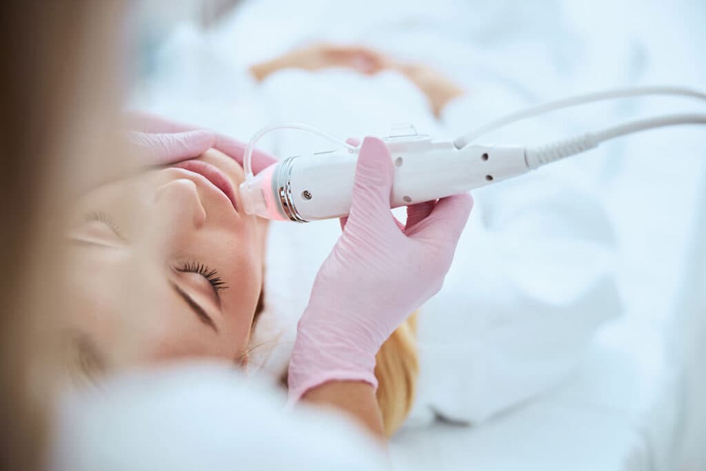juvederm ultra 3 – MorySkin führt die neuesten Filler der Branche