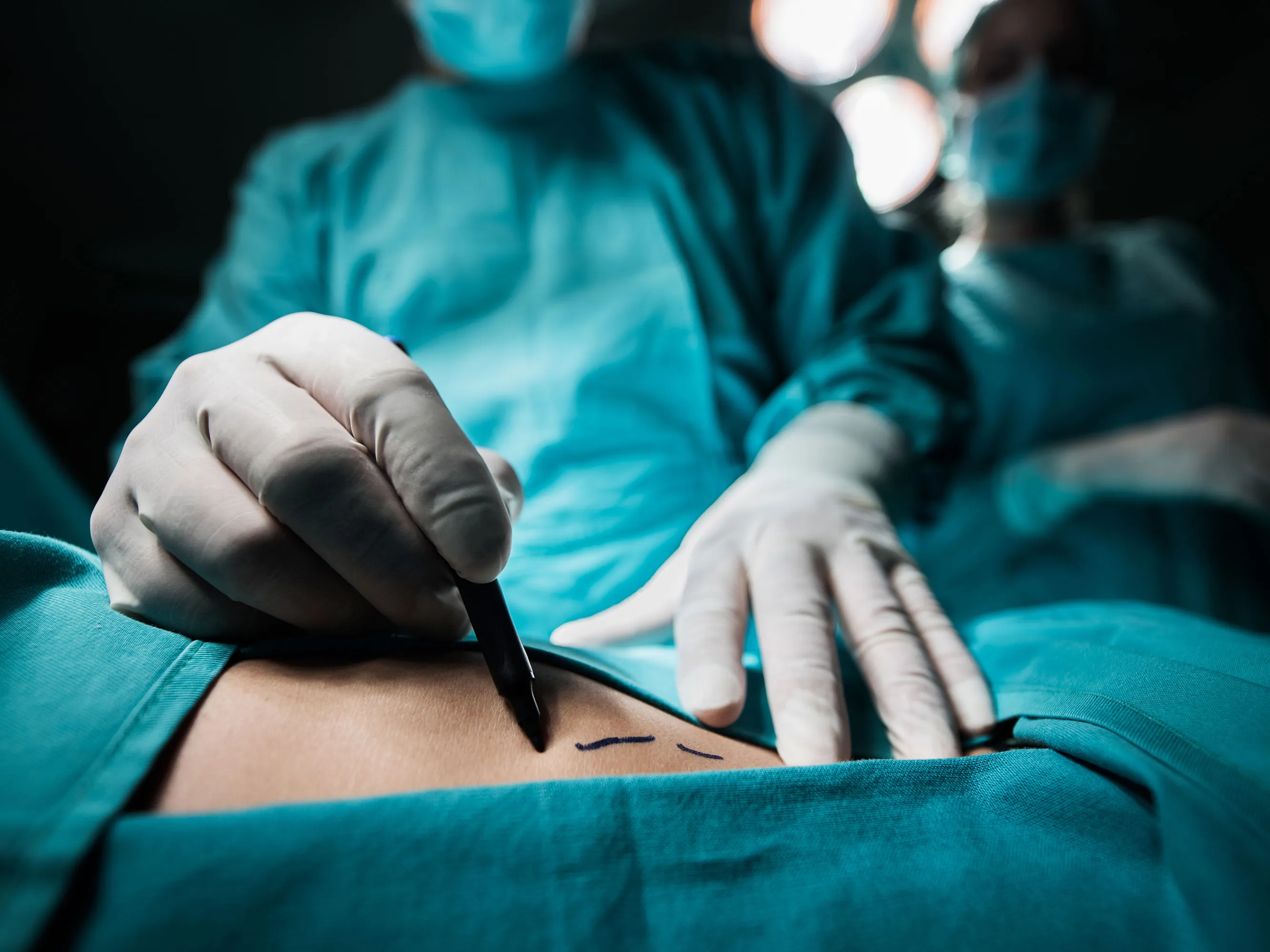 Plastische Chirurgie Bochum: Ihr Partner für ästhetische Körperformung