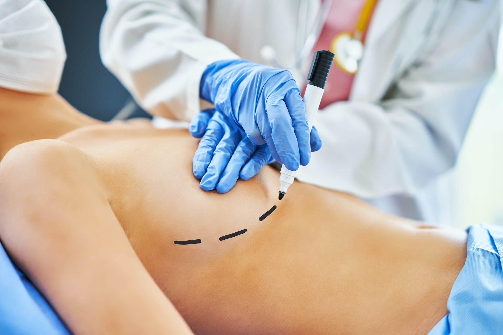 Plastische Chirurgie Bochum: Ihr Partner für ästhetische Körperformung